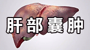 肝囊肿的源头已找到，烟酒排末位，第一名很多人天天都在做